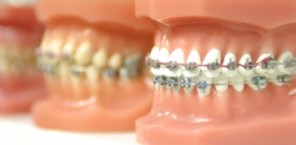 orthodontics